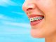 cuidar tu ortodoncia en verano
